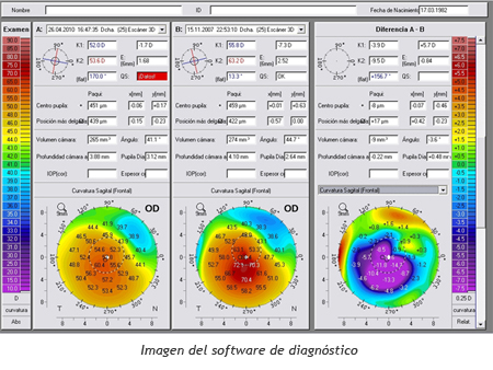 Tabla Comparativa de Operacion Vista
